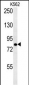 SLC4A7 Antibody (C-term)